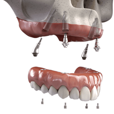 3RDset_Neoarch_1500-x-845-1-1