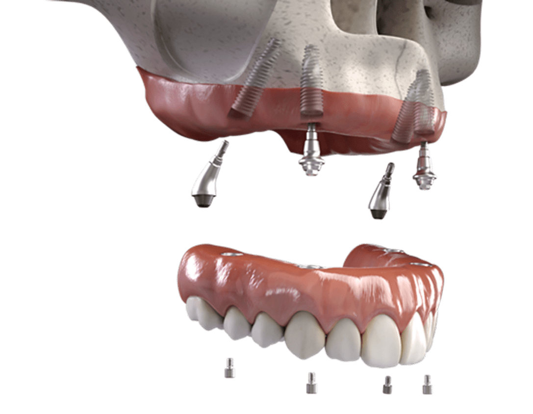 3RDset_Neoarch_1500-x-845-1