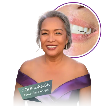 3rdSET_Implants_Las_Vegas_1-1-1